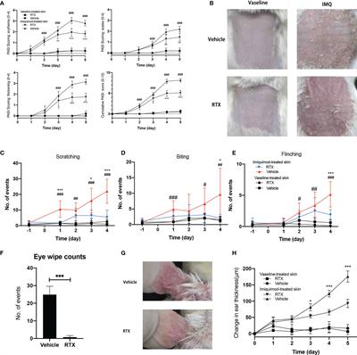 Nociceptive Sensory Fibers Drive Interleukin-23 Production in a Murine Model of Psoriasis via Calcitonin Gene-Related Peptide